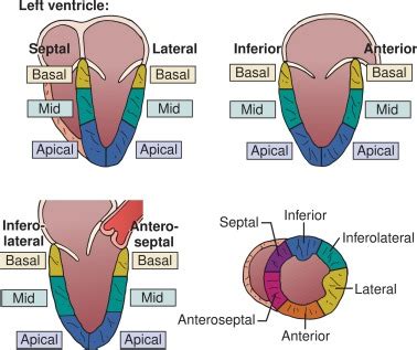 inferior basal hypokinesis